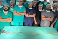 How Jaipur doctors removed the world longest hairball from teen girl's stomach suffering from 'Rapunzel sy