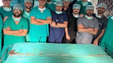 How Jaipur doctors removed the world longest hairball from teen girl's stomach suffering from 'Rapunzel sy
