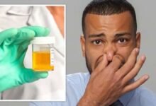 Smelly urine: Causes, other symptoms, treatment, and more